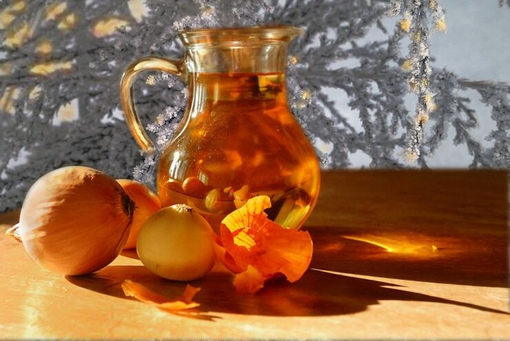 sipulikeite eturauhastulehdukseen